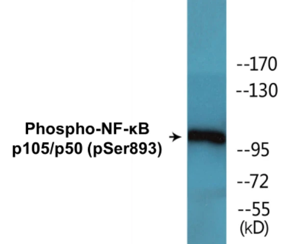 NF-kB p105 / p50 (phospho Ser893) Cell Based ELISA Kit (A102717-296)